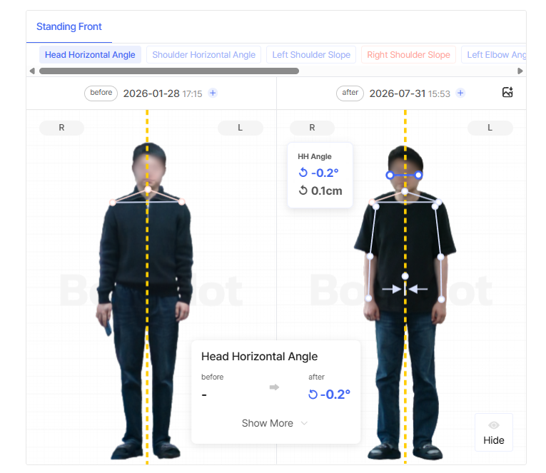 For indicators not included in the Comprehensive Assessment, the comparison screen displays a blank space.
